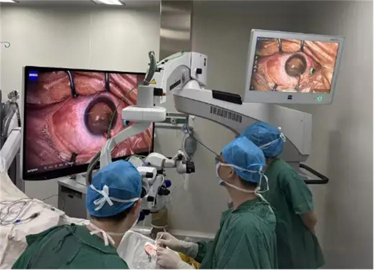 全国首批蔡司3D手术显微镜在厦门眼科中心投入使用(图3)